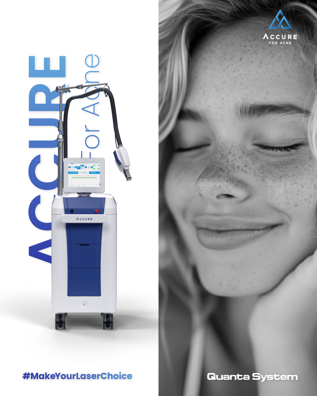 Accure Akne laser